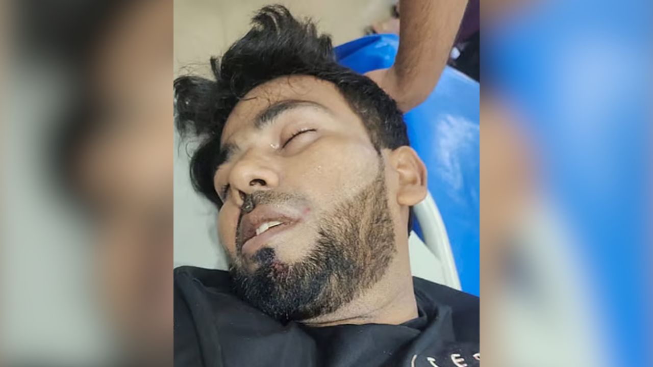 নোয়াখালীতে চাঁদা না পেয়ে প্রবাসীর আঙুল কেটে নিল দুর্বৃত্তরা